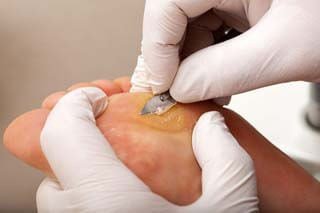 Advanced Foot Care Technology